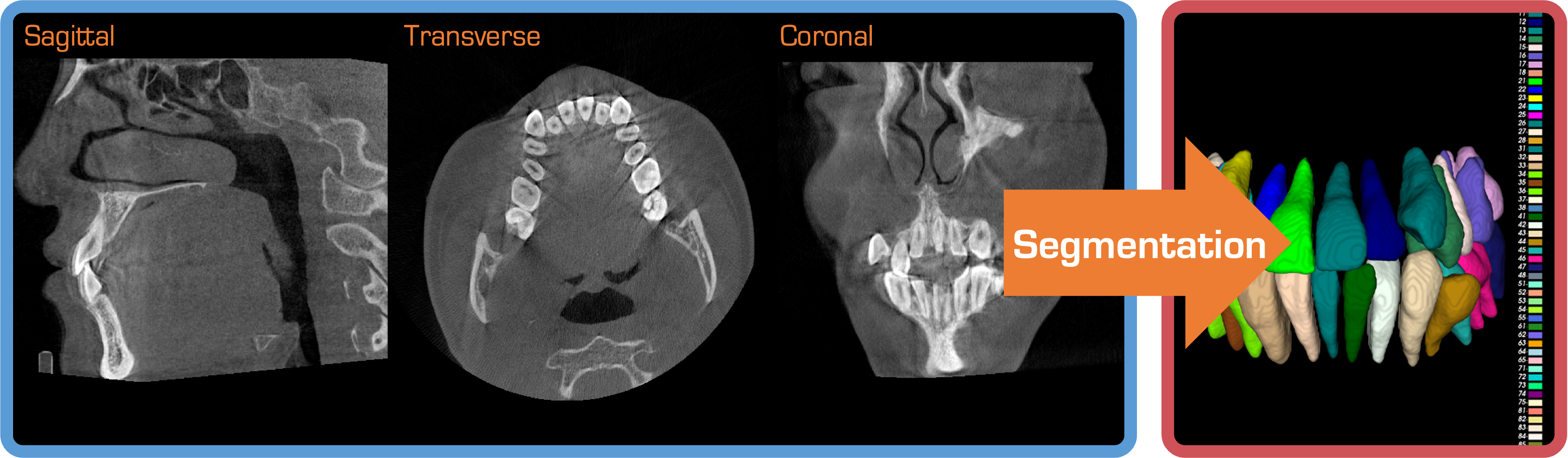 cbct-image